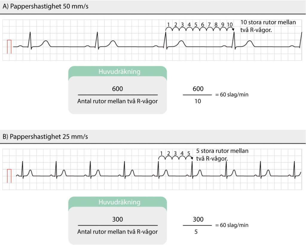 Figur 39. Uppskattning av hjärtfrekvensen utifrån EKG-remsan. Man behöver inte använda R-vågor; det går lika bra att mäta antal stora rutor mellan P-vågor, T-vågor eller någon annan struktur som återkommer regelbundet och som ger en enkel beräkning.