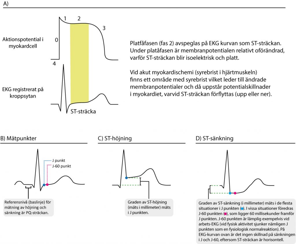 Figur 1. Samband mellan aktionspotentialen och EKG-kurvan. Ischemi påverkar ST-T-sträckan. ST-höjning och ST-sänkning mäts som regel i J punkten. I vissa situationer är det aktuellt att använda J-60 eller J-80 punkten (exempelvis vid arbets-EKG).