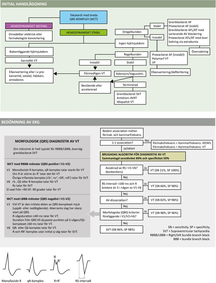 Figur 62. Diagnostik och handläggning av takyarytmi med breda QRS-komplex.