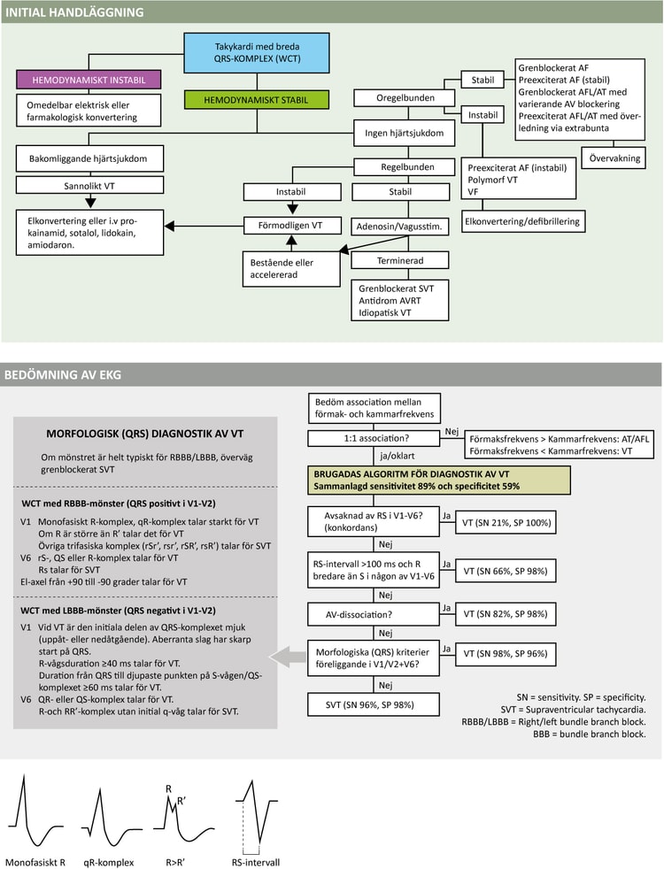 Figure 62. Diagnostik och handläggning av takyarytmi med breda QRS-komplex.