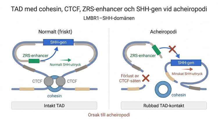 TAD med cohesin, CTCF, ZRS-enhancer och SHH-gen vid acheiropodi