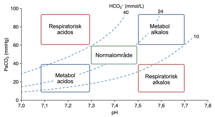 Syra-basnomogram med pH, koldioxidtryck och bikarbonatkoncentration.