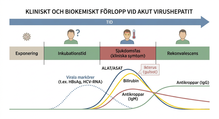 Schema över kliniskt och biokemiskt förlopp vid akut virushepatit.