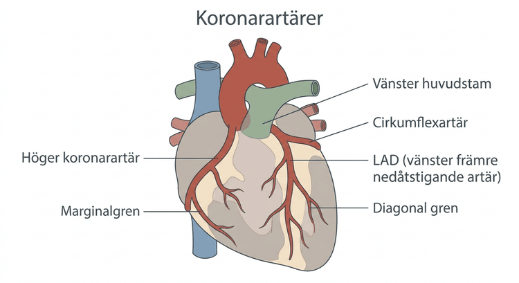 Schematisk bild av höger och vänster koronarartär med LAD, cirkumflexartär och större grenar.