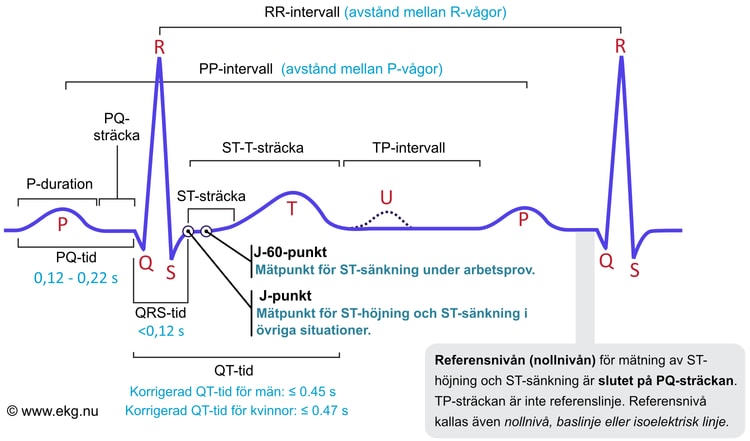 Figur 1. Den klassiska EKG-kurvan. Kammarkomplexet kallas även QRS-komplex, oavsett om det saknas någon av vågorna, Q, R eller S.