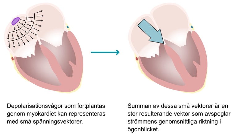 Figur 5. Principen för elektriska vektorer i hjärtat. När impulsen (depolarisationen) sprids genom myokardiet kan varje impulsvåg representeras med en liten vektor (små pilar). Den genomsnittliga strömriktningen i varje ögonblick är den större resulterande (genomsnittliga) vektorn (högra bilden). EKG-kurvan avspeglar de större vektorerna under hjärtcykeln.
