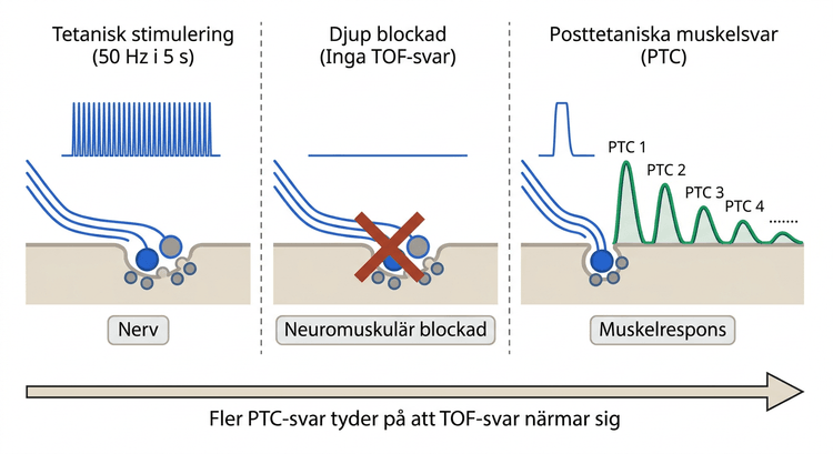 Schema över tetanisk stimulering följd av posttetaniska muskelsvar.