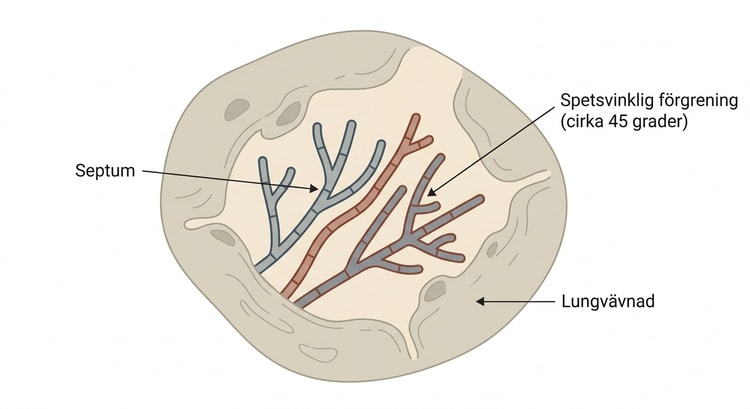Histologisk bild med septata, jämntjocka och spetsvinkligt förgrenade Aspergillus-hyfer i lungvävnad.