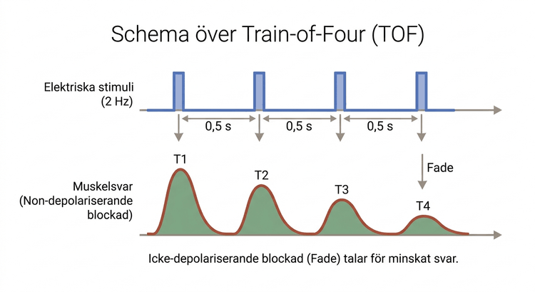 Schema över train-of-four med fyra elektriska stimuli och muskelsvar.