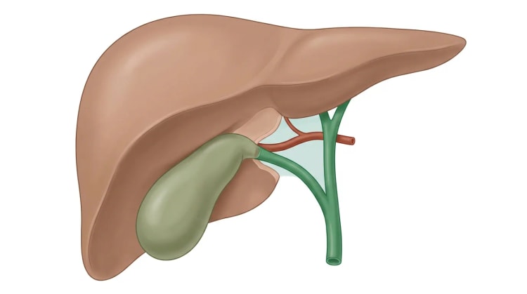 Illustration av levern och gallblåsan framifrån. En grön ductus cysticus och en röd arteria cystica är de enda strukturerna som går in i gallblåsehalsen, genom en rensad hepatocystisk triangel mot en ljusare, frilagd leverbädd.
