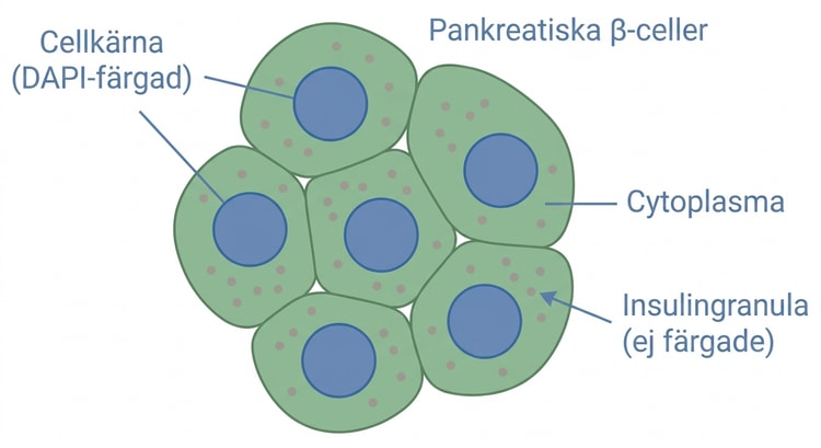 Mikroskopibild av pankreatiska betaceller med DAPI-färgade cellkärnor