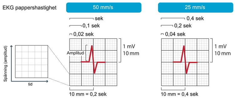 Figur 1. Pappershastighet och amplituder. I Sverige används 50 mm/s som standard men de flesta maskiner har flera hastighetsalternativ. Vid rytmregistrering är 25 mm/s eller 10 mm/s vanligt.