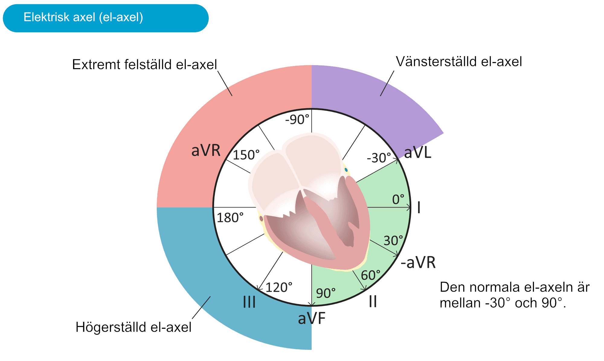 Hjärtats elektriska axel beräknad i extremitetsavledningarna, med normal, vänsterställd och högerställd axel.