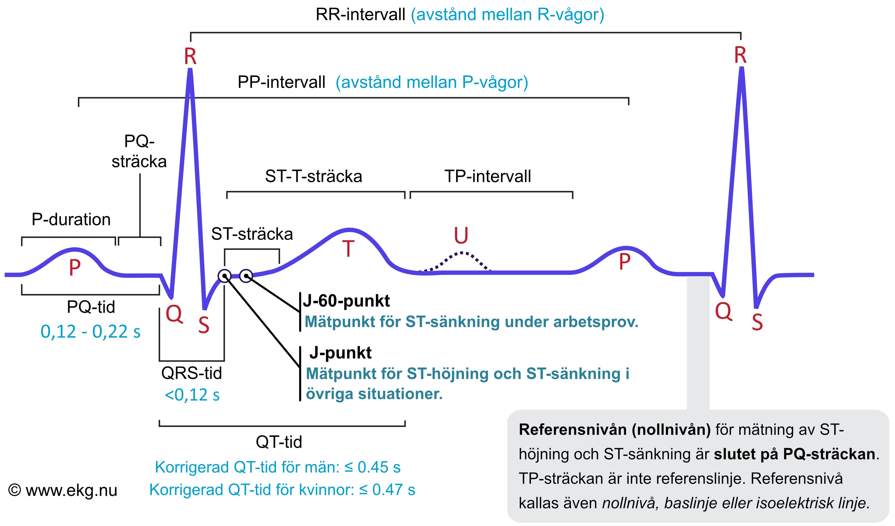 Den klassiska EKG-kurvan med P-våg, PQ-tid, QRS-komplex, J-punkt, ST-sträcka, T-våg och QT-tid utmärkta.