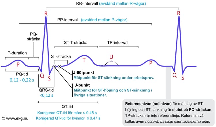 Figur 1. Den klassiska EKG-kurvan. Kammarkomplexet kallas även QRS-komplex, oavsett om det saknas någon av vågorna, Q, R eller S.