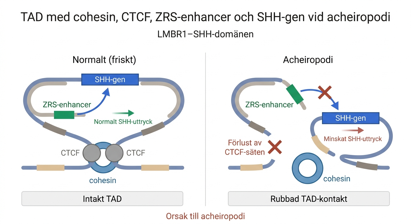 TAD med cohesin, CTCF, ZRS-enhancer och SHH-gen vid acheiropodi