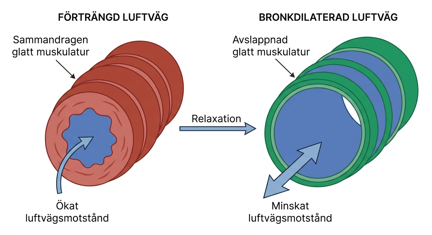 Schematisk jämförelse mellan förträngd och bronkdilaterad luftväg