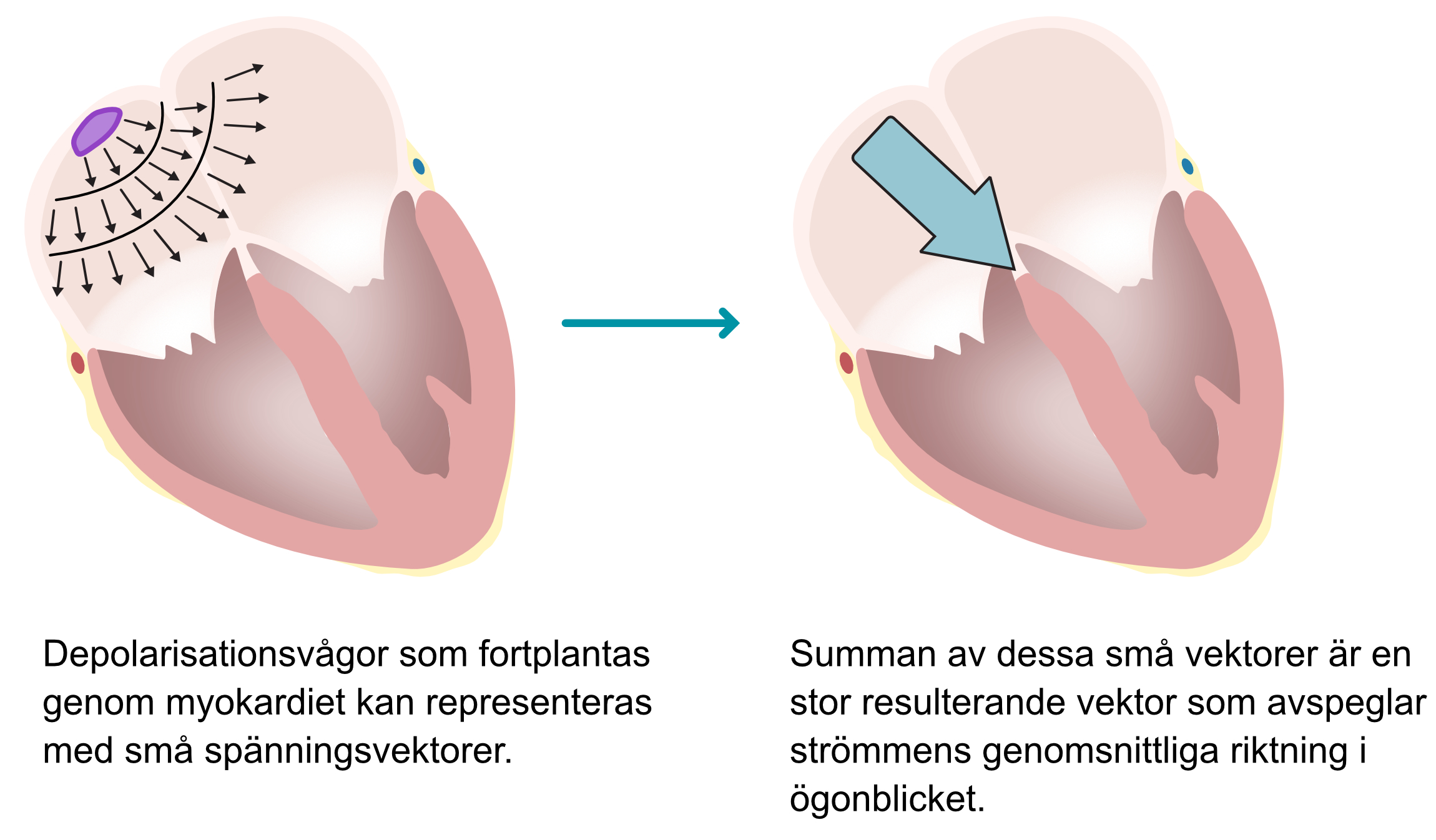 Figur 5. Principen för elektriska vektorer i hjärtat. När impulsen (depolarisationen) sprids genom myokardiet kan varje impulsvåg representeras med en liten vektor (små pilar). Den genomsnittliga strömriktningen i varje ögonblick är den större resulterande (genomsnittliga) vektorn (högra bilden). EKG-kurvan avspeglar de större vektorerna under hjärtcykeln.