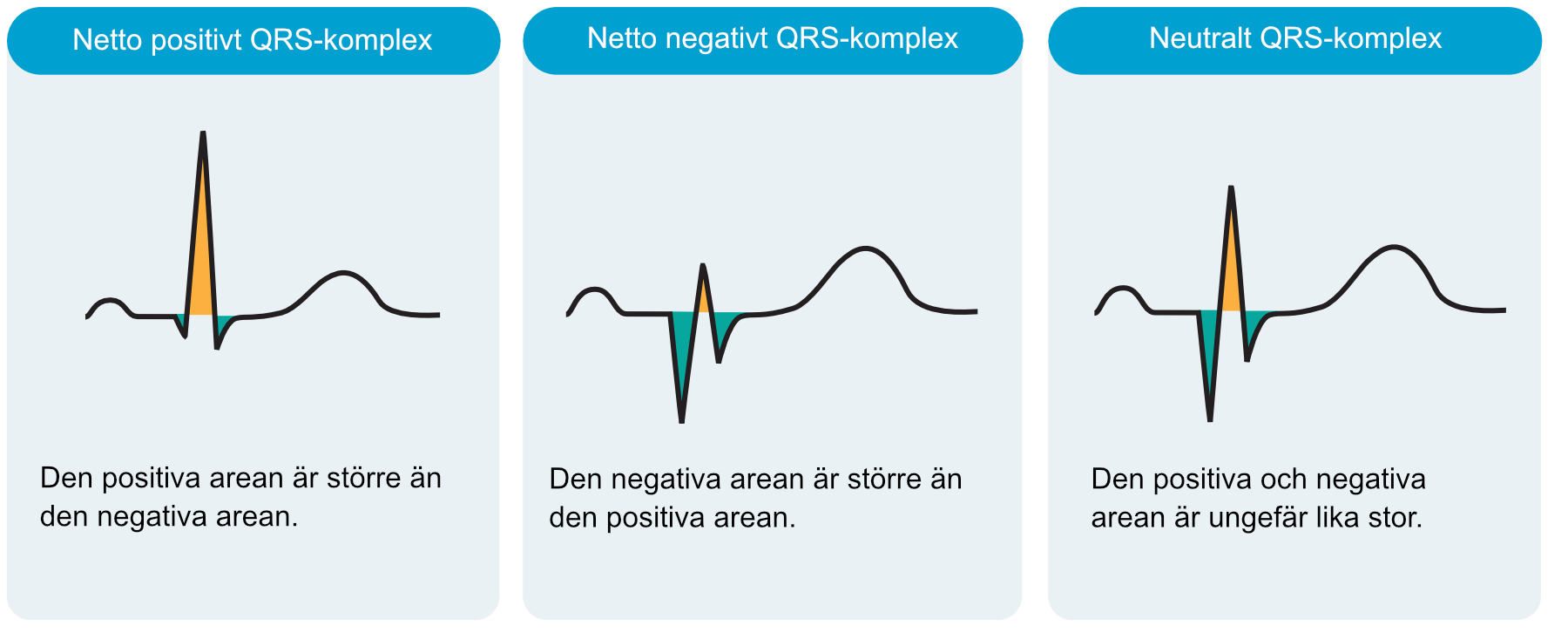 Positiva och negativa kammarkomplex med nettoutslag
