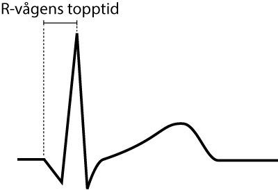 Schematisk bild av R-vågens topptid mätt från QRS-komplexets början till R-vågens topp