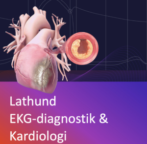 Diagnos och behandling av akut bradykardi (bradyarytmi) - Klinisk ...