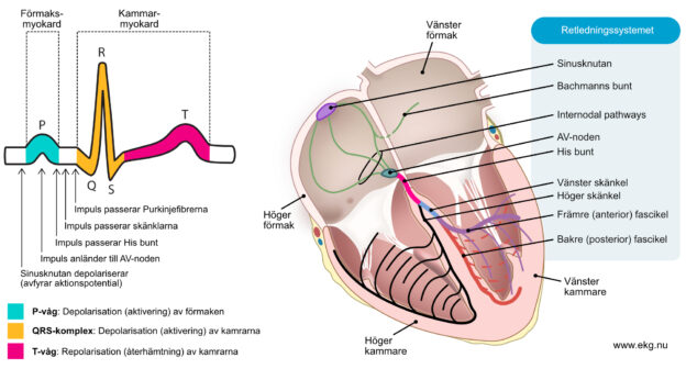 Figur 1. Hjärtats fyra rum och retledningssystemet. Från sinusknutan avfyras en depolariserande impuls som färdas genom förmaken och via AV-noden till kammarna. Impulsen aktiverar hjärtmuskelcellerna som därmed kontraherar. Strömmen som alstras när förmak- och kammarmyokard aktiveras ger upphov till den klassiska EKG-kurvan. Förmakens aktivering ger upphov till P-vågen på EKG-kurvan. Kammarnas aktivering ger upphov till QRS-komplexet. Kammarnas återställning avspeglas i T-vågen.